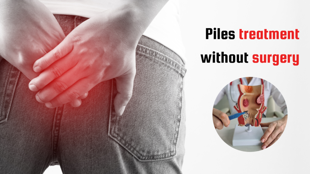 piles treatment without surgery